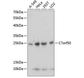 Western Blot - Anti-C7orf50 Antibody (A91989) - Antibodies.com