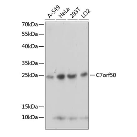 Western Blot - Anti-C7orf50 Antibody (A91989) - Antibodies.com