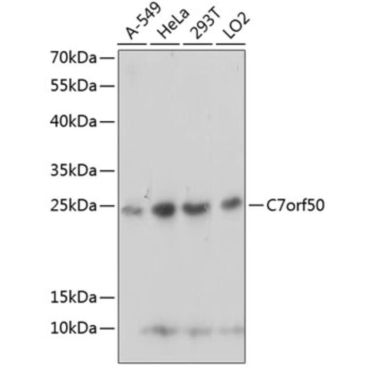 Western Blot - Anti-C7orf50 Antibody (A91989) - Antibodies.com