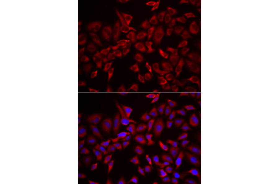 Immunofluorescence - Anti-CSRP3 Antibody (A13372) - Antibodies.com
