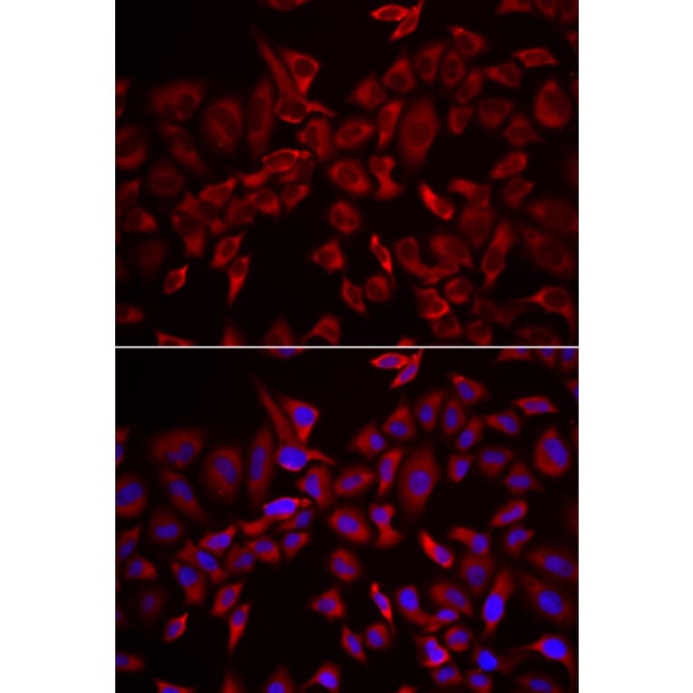 Immunofluorescence - Anti-CSRP3 Antibody (A13372) - Antibodies.com