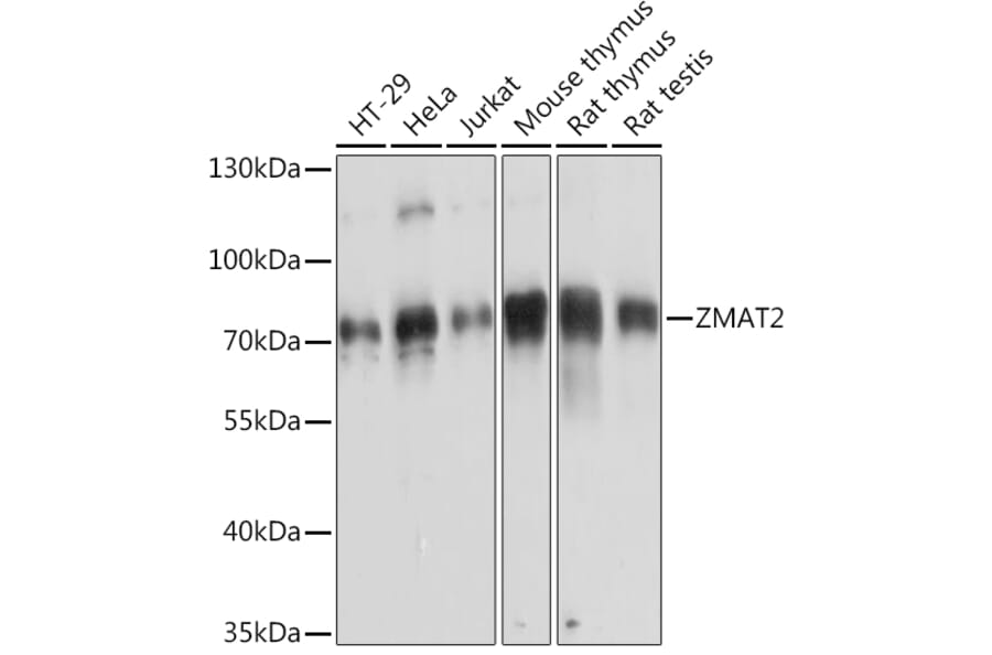 Western Blot - Anti-Zmat2 Antibody (A91991) - Antibodies.com