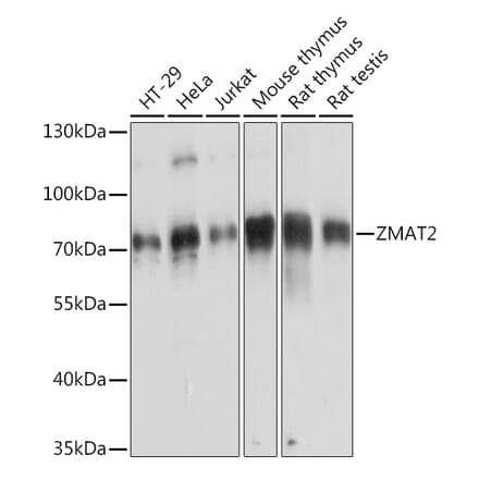 Western Blot - Anti-Zmat2 Antibody (A91991) - Antibodies.com