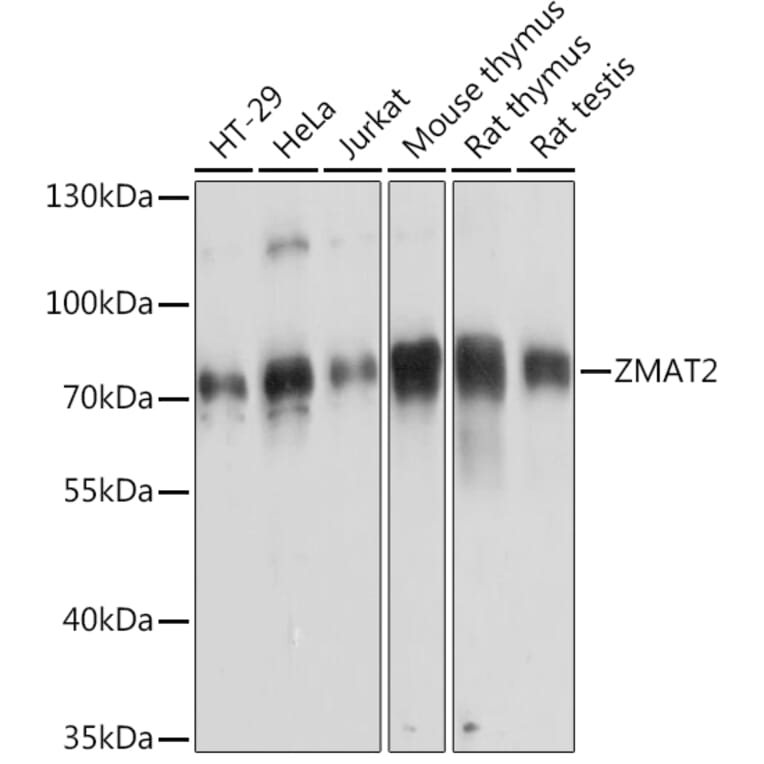 Western Blot - Anti-Zmat2 Antibody (A91991) - Antibodies.com