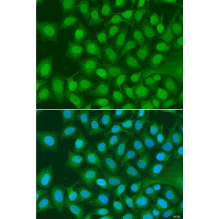 Immunofluorescence - Anti-ATG4C Antibody (A15200) - Antibodies.com