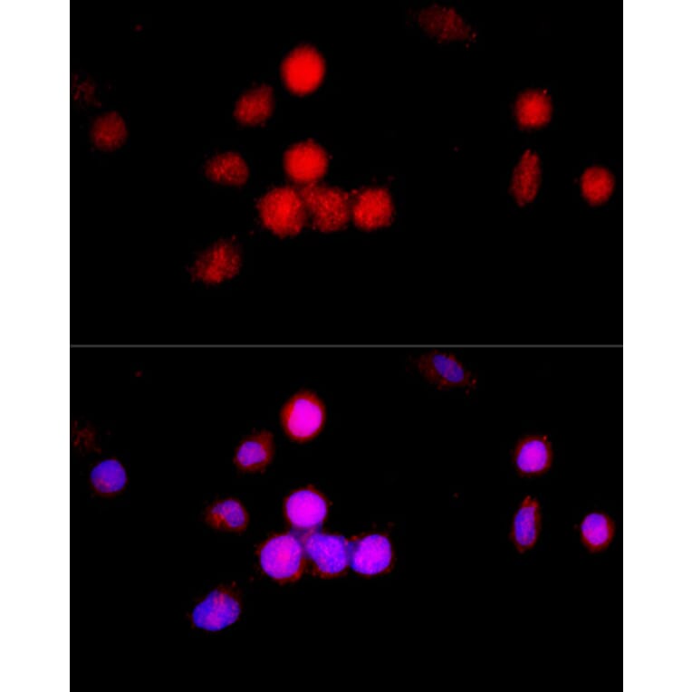Immunofluorescence - Anti-CCNA2 Antibody (A15036) - Antibodies.com