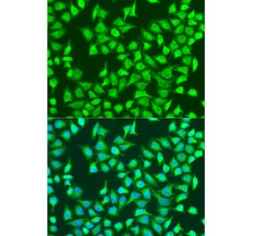 Immunofluorescence - Anti-SIRT4 Antibody (A91998) - Antibodies.com