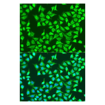 Immunofluorescence - Anti-SIRT4 Antibody (A91998) - Antibodies.com