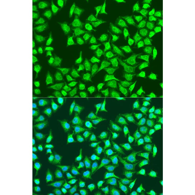 Immunofluorescence - Anti-SIRT4 Antibody (A91998) - Antibodies.com