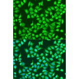 Immunofluorescence - Anti-SIRT4 Antibody (A91998) - Antibodies.com