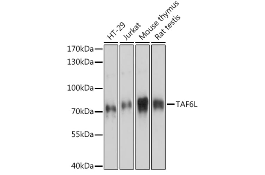 Western Blot - Anti-TAF6L Antibody (A91999) - Antibodies.com