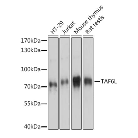 Western Blot - Anti-TAF6L Antibody (A91999) - Antibodies.com