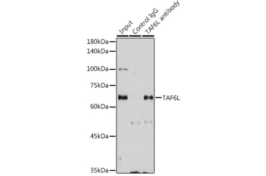 Western Blot - Anti-TAF6L Antibody (A91999) - Antibodies.com