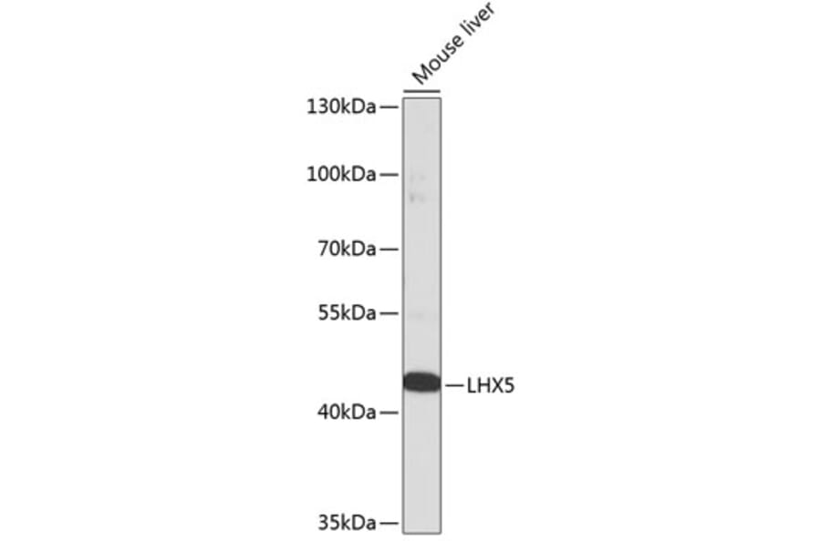 Western Blot - Anti-LHX5 Antibody (A92000) - Antibodies.com