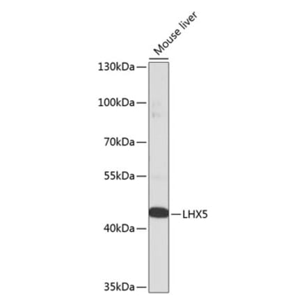 Western Blot - Anti-LHX5 Antibody (A92000) - Antibodies.com