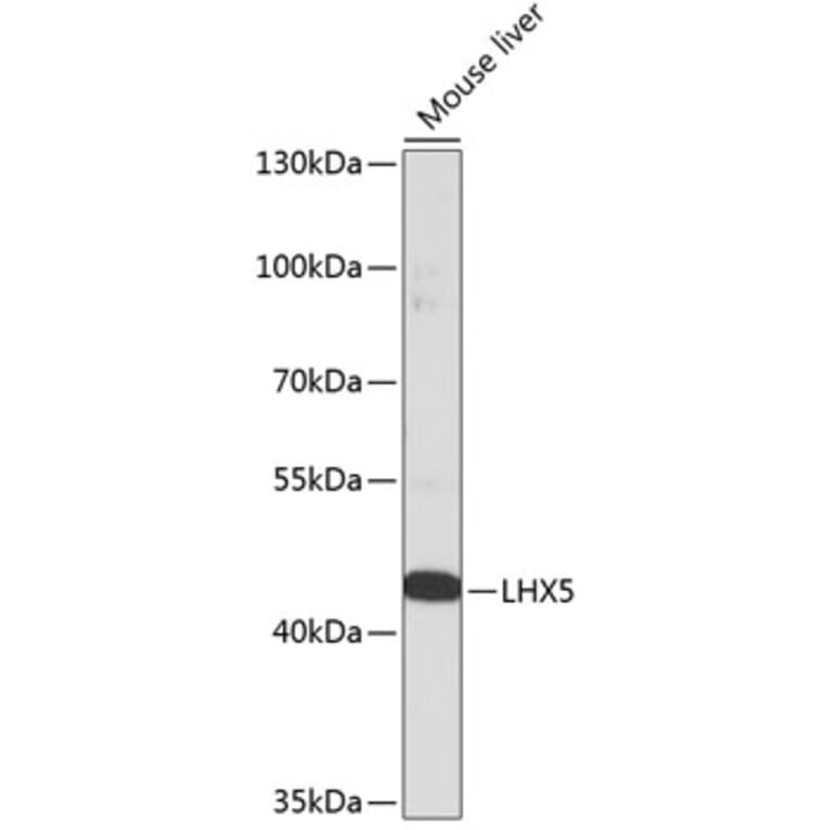 Western Blot - Anti-LHX5 Antibody (A92000) - Antibodies.com