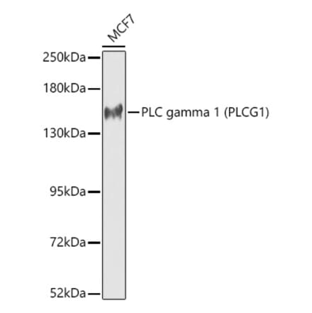 Western Blot - Anti-PLC-gamma-1 Antibody (A92001) - Antibodies.com