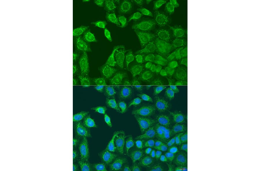 Immunofluorescence - Anti-AANAT Antibody (A15016) - Antibodies.com