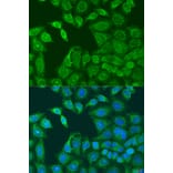 Immunofluorescence - Anti-AANAT Antibody (A15016) - Antibodies.com