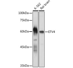 Western Blot - Anti-Pea3 Antibody (A92006) - Antibodies.com