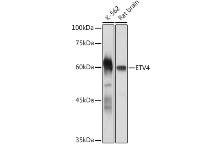 Western Blot - Anti-Pea3 Antibody (A92006) - Antibodies.com