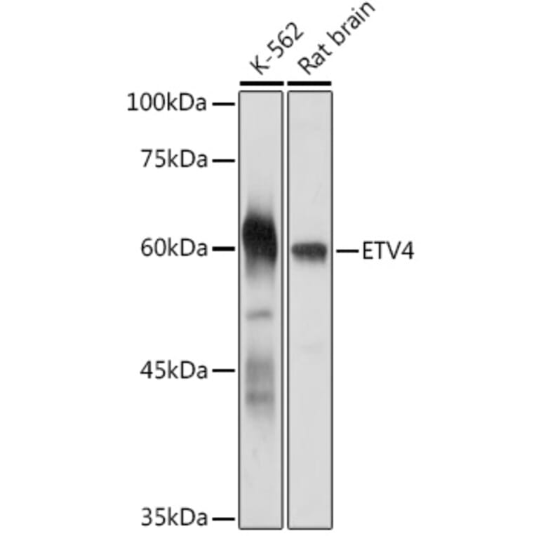 Western Blot - Anti-Pea3 Antibody (A92006) - Antibodies.com