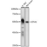 Western Blot - Anti-Pea3 Antibody (A92006) - Antibodies.com