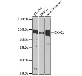 Western Blot - Anti-CGBP Antibody (A92007) - Antibodies.com