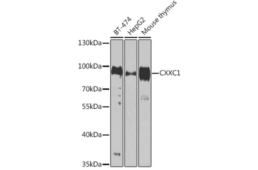 Western Blot - Anti-CGBP Antibody (A92007) - Antibodies.com