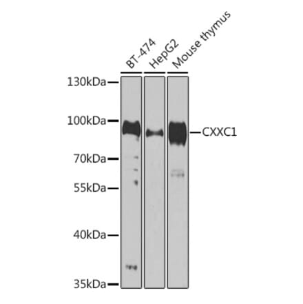 Western Blot - Anti-CGBP Antibody (A92007) - Antibodies.com