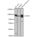 Western Blot - Anti-CGBP Antibody (A92007) - Antibodies.com