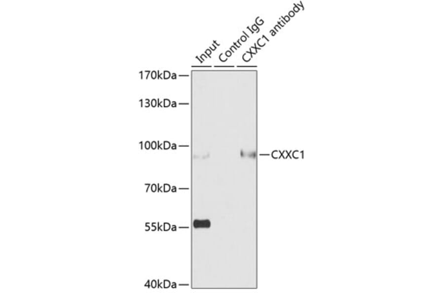 Western Blot - Anti-CGBP Antibody (A92007) - Antibodies.com