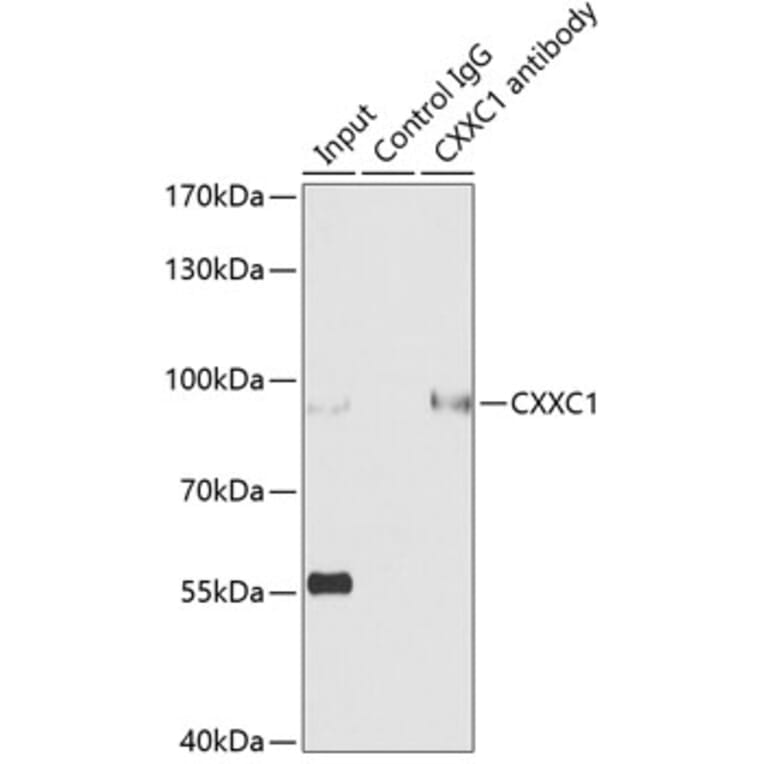 Western Blot - Anti-CGBP Antibody (A92007) - Antibodies.com