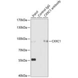 Western Blot - Anti-CGBP Antibody (A92007) - Antibodies.com