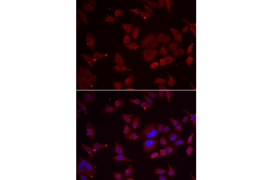 Immunofluorescence - Anti-PFKFB3 Antibody (A92008) - Antibodies.com