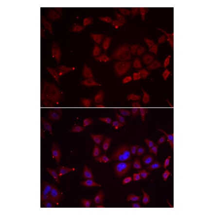 Immunofluorescence - Anti-PFKFB3 Antibody (A92008) - Antibodies.com