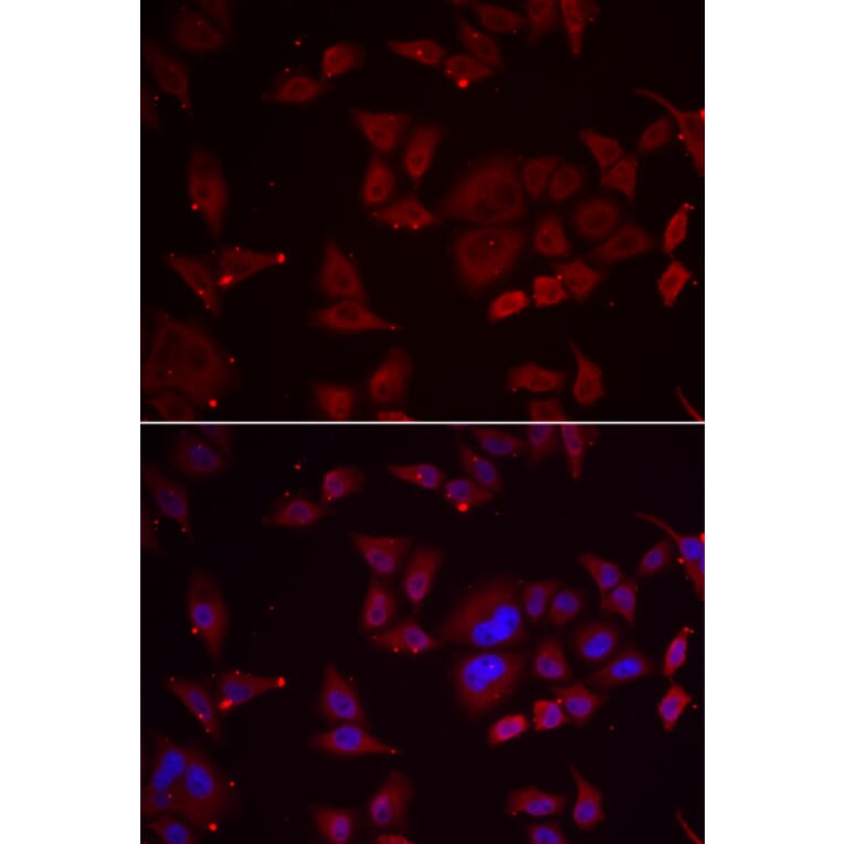 Immunofluorescence - Anti-PFKFB3 Antibody (A92008) - Antibodies.com