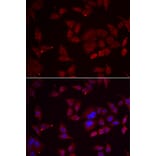 Immunofluorescence - Anti-PFKFB3 Antibody (A92008) - Antibodies.com