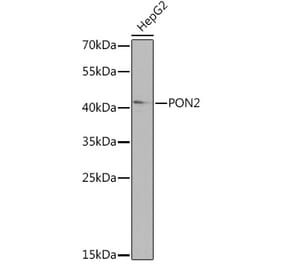 Western Blot - Anti-PON2 Antibody (A92009) - Antibodies.com