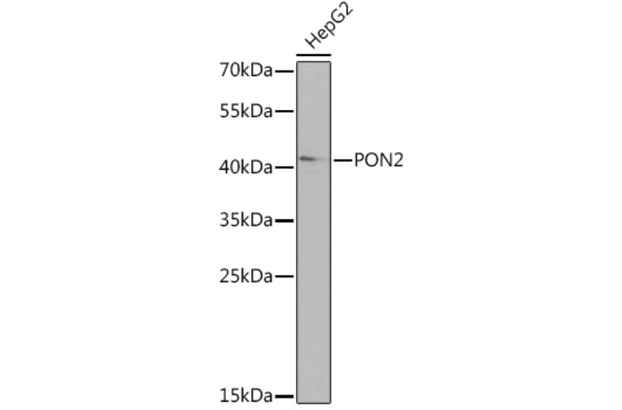 Western Blot - Anti-PON2 Antibody (A92009) - Antibodies.com
