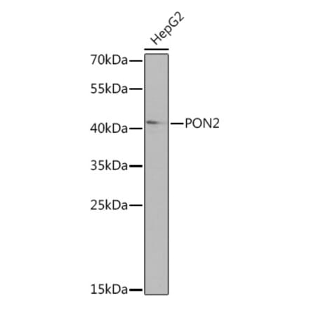 Western Blot - Anti-PON2 Antibody (A92009) - Antibodies.com