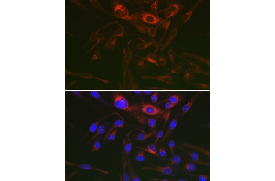 Immunofluorescence - Anti-PRKAG3 Antibody (A92010) - Antibodies.com