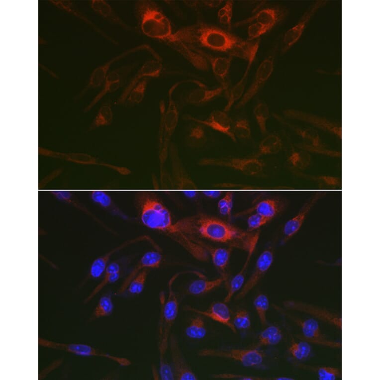 Immunofluorescence - Anti-PRKAG3 Antibody (A92010) - Antibodies.com