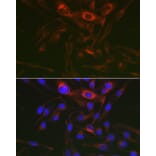 Immunofluorescence - Anti-PRKAG3 Antibody (A92010) - Antibodies.com