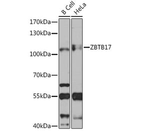 Western Blot - Anti-Miz1 Antibody (A92013) - Antibodies.com