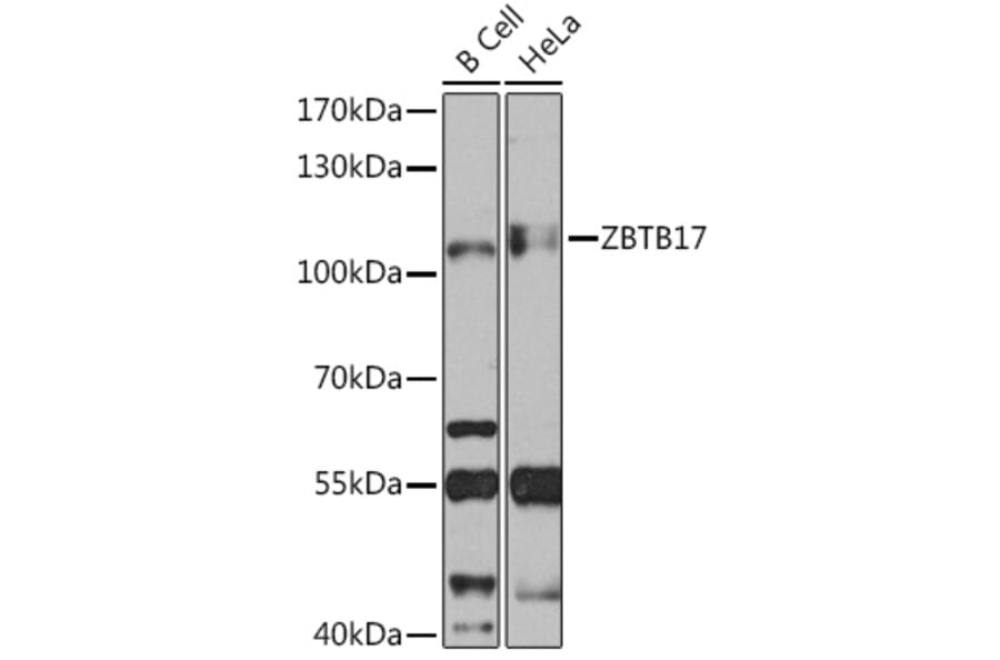 Western Blot - Anti-Miz1 Antibody (A92013) - Antibodies.com