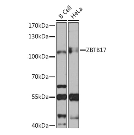 Western Blot - Anti-Miz1 Antibody (A92013) - Antibodies.com