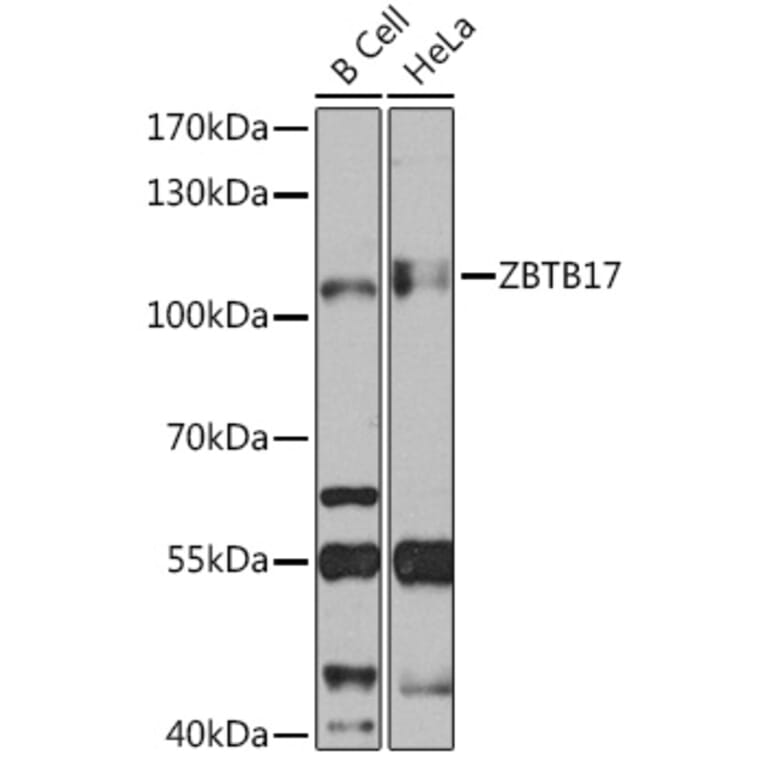 Western Blot - Anti-Miz1 Antibody (A92013) - Antibodies.com