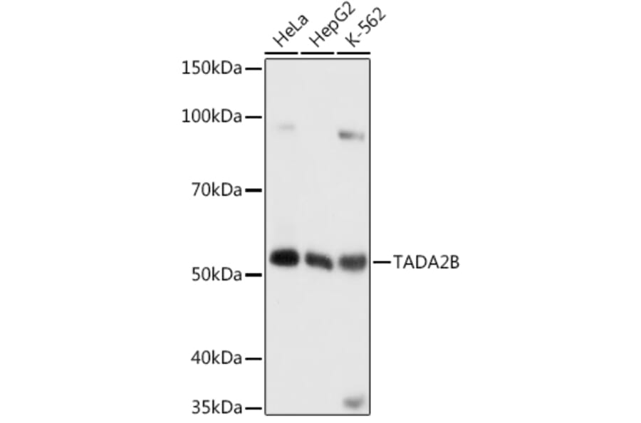 Western Blot - Anti-TADA2B Antibody (A92014) - Antibodies.com