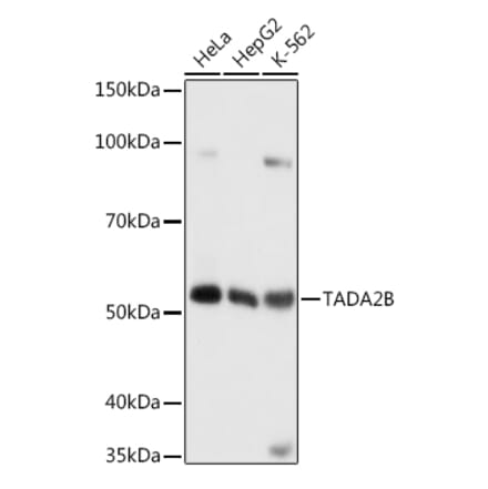Western Blot - Anti-TADA2B Antibody (A92014) - Antibodies.com